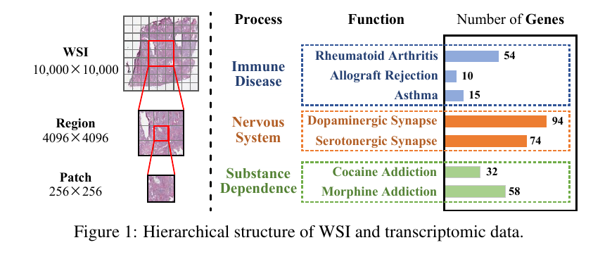SurvMamba: State Space Model with Multi-Grained Multi-Modal Interaction for Survival Prediction